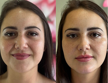 Template de post feed antes e depois 1